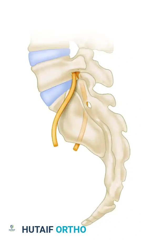 Mastering Posterior Screw Fixation for Sacral Fractures and Sacroiliac Dislocations