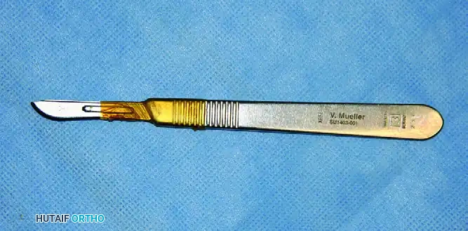 INTERTROCHANTERIC FEMORAL FRACTURES Surgical Diagram