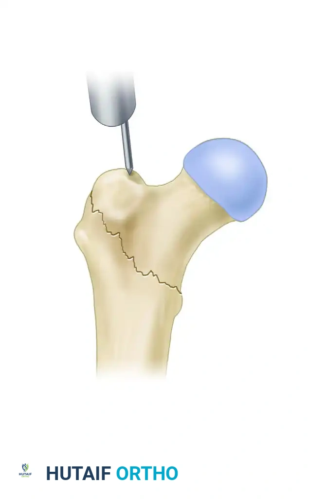 Hutaifortho's Orthopaedic Diagram