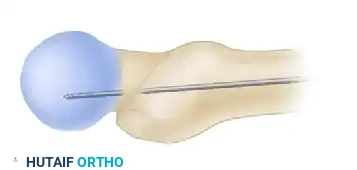 Hutaifortho's Orthopaedic Diagram