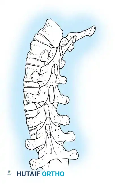 Crankshaft Phenomenon Diagram B