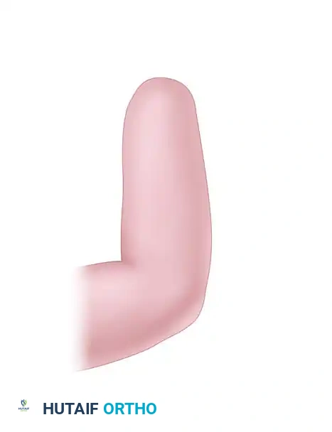 Krukenberg Reconstruction: Comprehensive Surgical Technique and Biomechanics