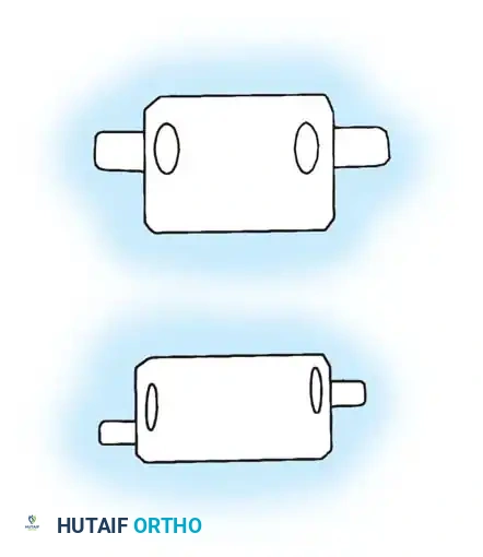 KYPHOSCOLIOSIS Surgical Diagram