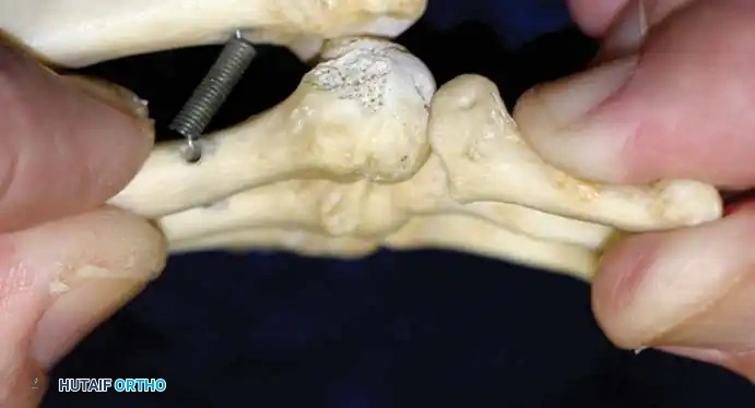 Lachman Test Starting Position