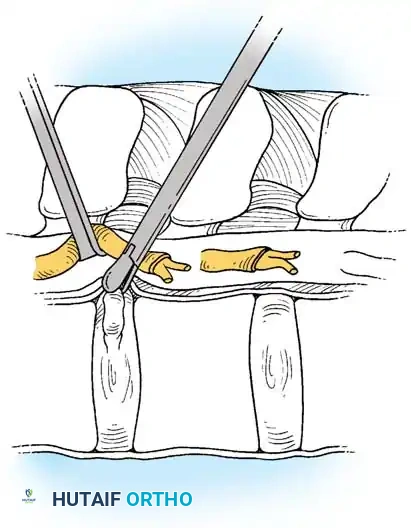 Hutaifortho's Orthopaedic Diagram