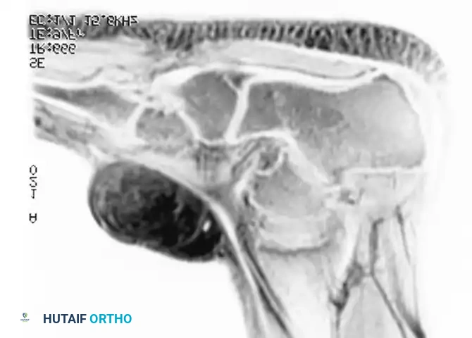 Hutaifortho's Orthopaedic Diagram