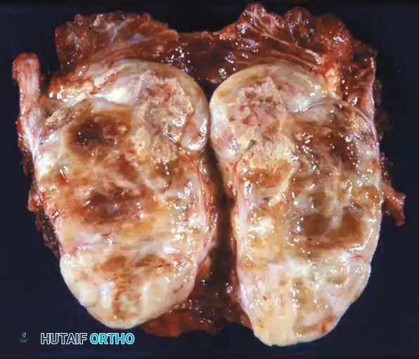 Hutaifortho's Orthopaedic Diagram