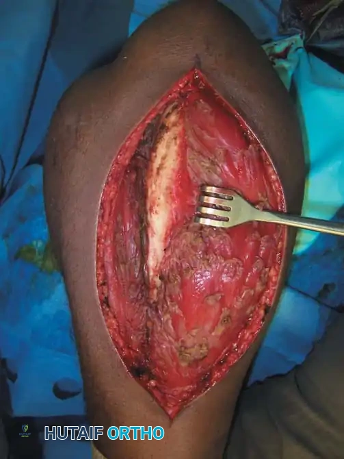 Hutaifortho's Orthopaedic Diagram
