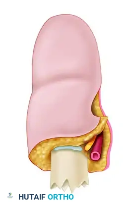 Bone and Joint Management in Replantation Surgery