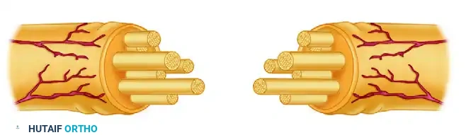 Management of Digital Nerve Injuries and Interfascicular Grafting