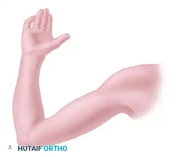 شق جراحي في الكوع لاستئصال اللقيمة الأنسية