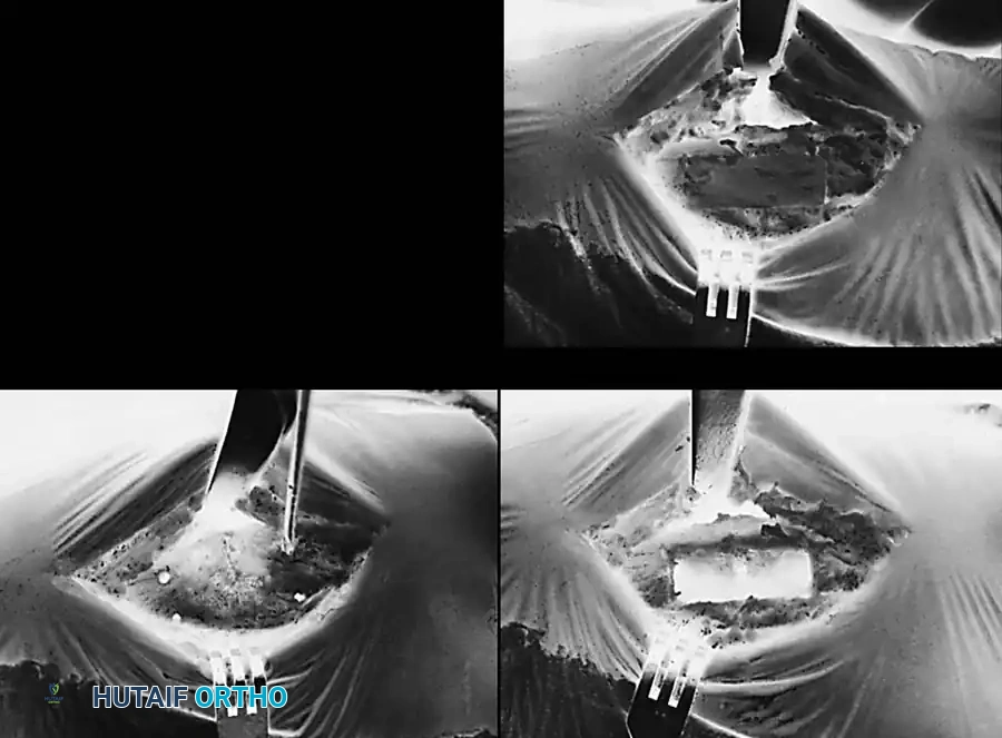 Hutaifortho's Orthopaedic Diagram