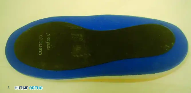 استخدام دعامات كربونية داخل الحذاء لدعم القدم بعد الجراحة