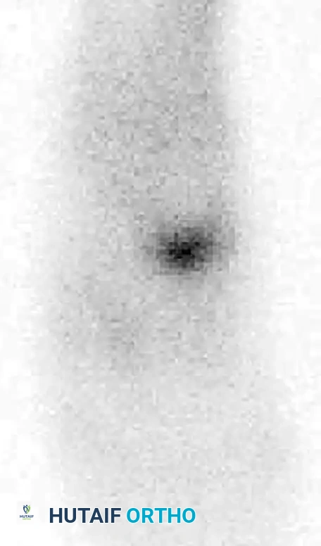 MIDFOOT FRACTURES AND DISLOCATIONS Surgical Diagram