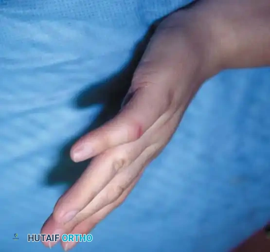 Hutaifortho's Orthopaedic Diagram