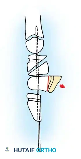 Hutaifortho's Orthopaedic Diagram