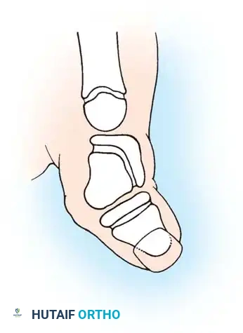 Hutaifortho's Orthopaedic Diagram