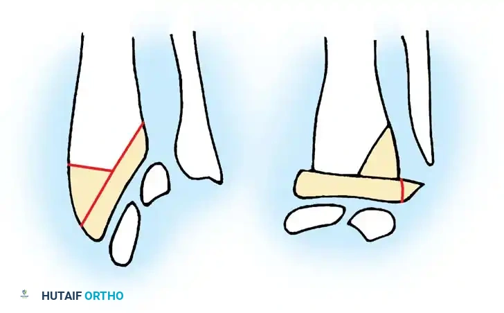 Hutaifortho's Orthopaedic Diagram