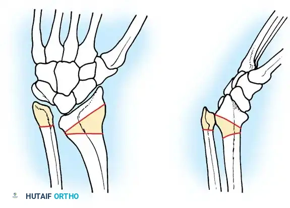 Hutaifortho's Orthopaedic Diagram