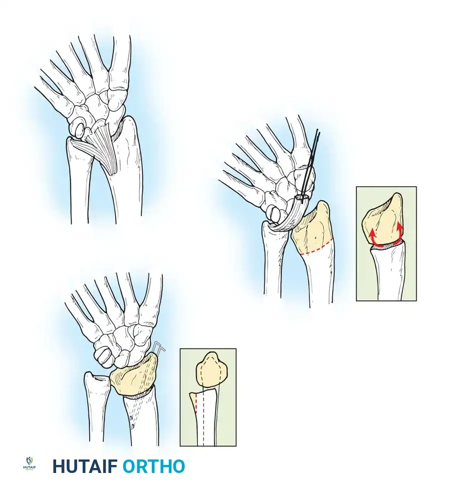 Hutaifortho's Orthopaedic Diagram