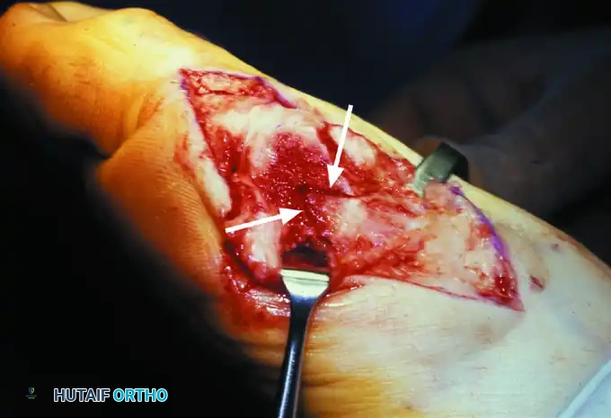 Hutaifortho's Orthopaedic Diagram