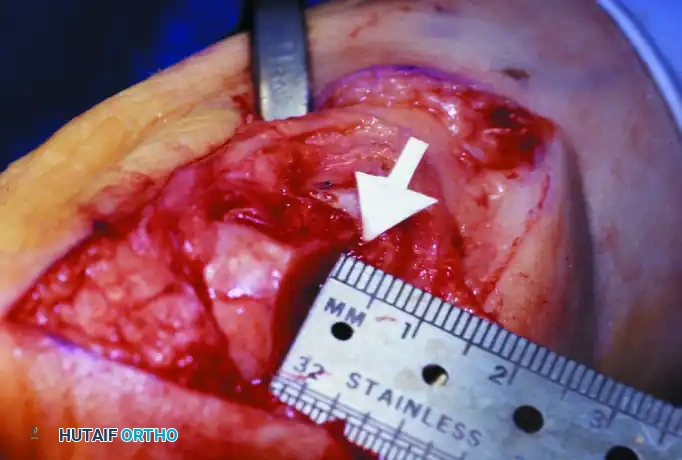 Hutaifortho's Orthopaedic Diagram