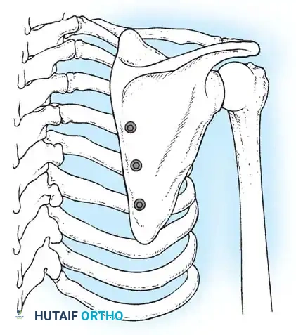 Hutaifortho's Orthopaedic Diagram