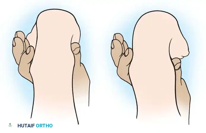 Hutaifortho's Orthopaedic Diagram