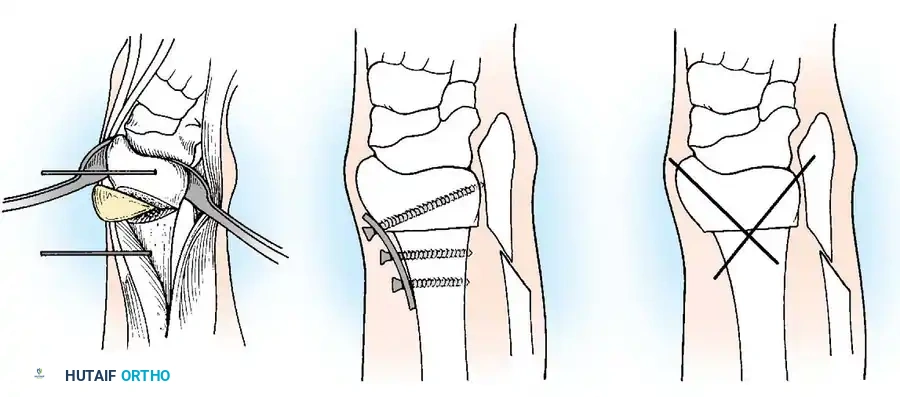 Hutaifortho's Orthopaedic Diagram