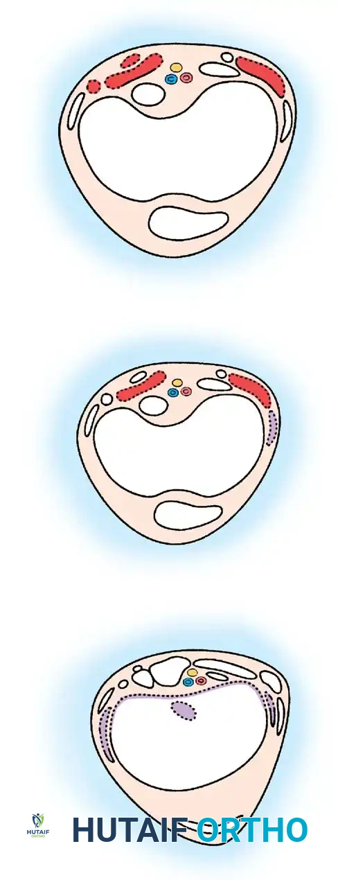 Spinal Deformity Radiograph