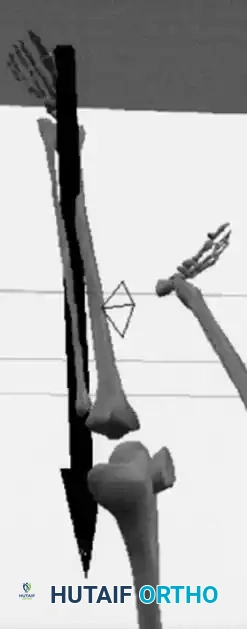 Urological Management Algorithm