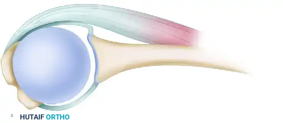 Infraspinatus muscle