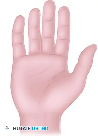 Comprehensive Management of Peripheral Nerve Injuries in the Hand