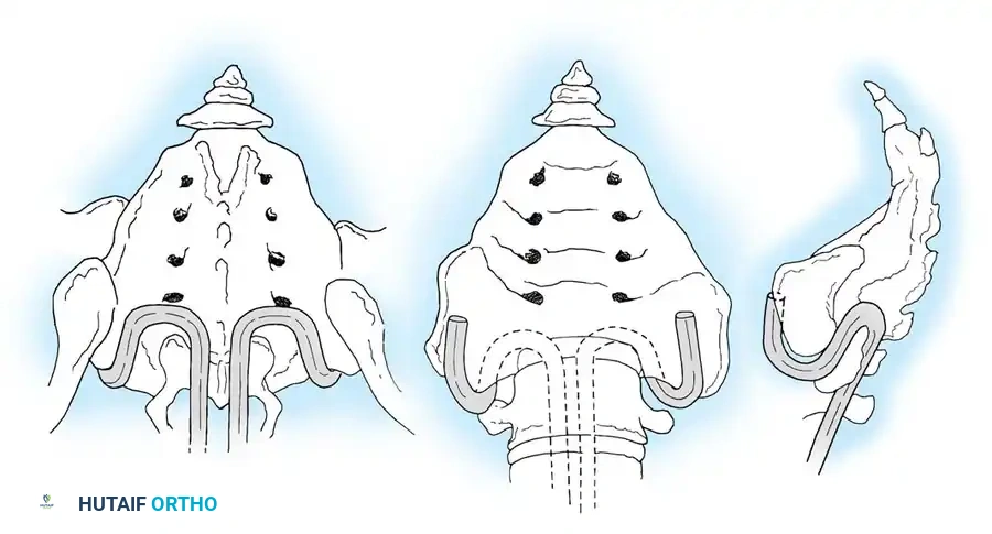 Hutaifortho's Orthopaedic Diagram