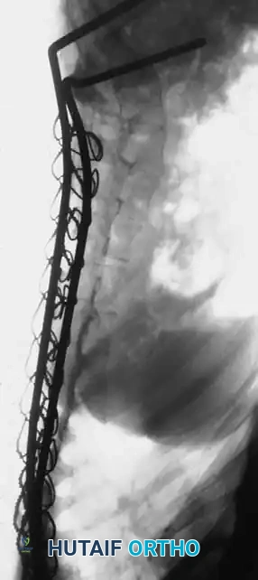 Hutaifortho's Orthopaedic Diagram