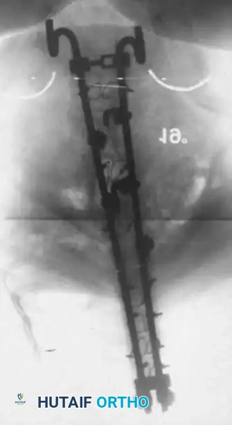 Hutaifortho's Orthopaedic Diagram