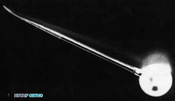 Hutaifortho's Orthopaedic Diagram