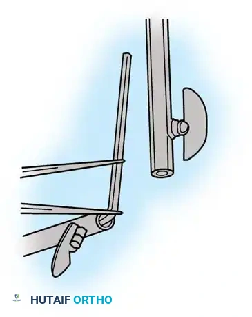 Hutaifortho's Orthopaedic Diagram