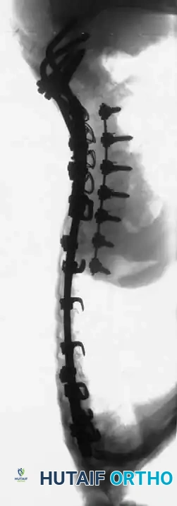 Hutaifortho's Orthopaedic Diagram