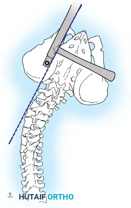 Hutaifortho's Orthopaedic Diagram