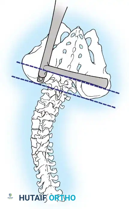 Hutaifortho's Orthopaedic Diagram