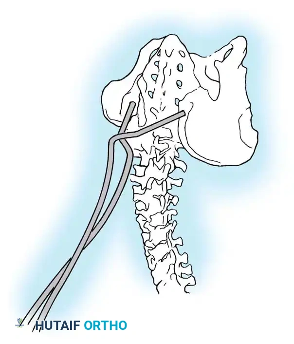 Hutaifortho's Orthopaedic Diagram