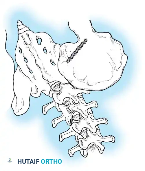 Hutaifortho's Orthopaedic Diagram