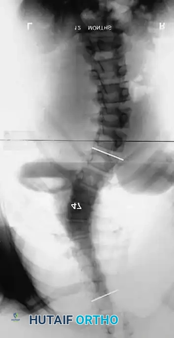 Hutaifortho's Orthopaedic Diagram