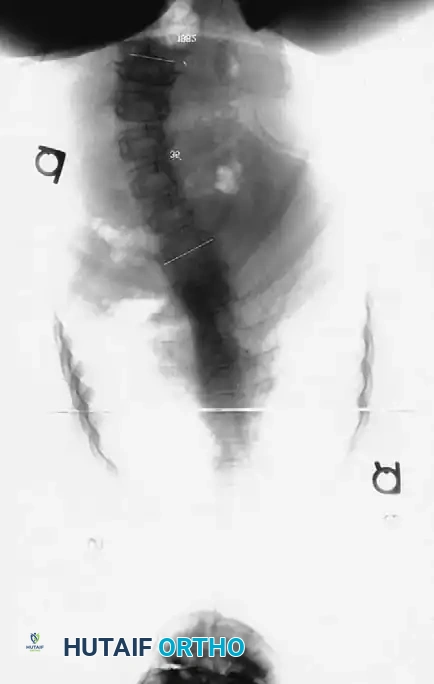 Hutaifortho's Orthopaedic Diagram