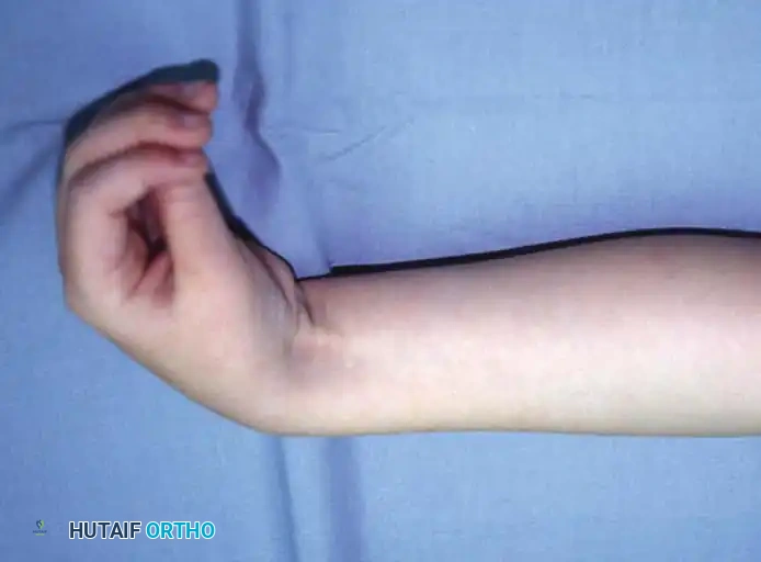 NONOPERATIVE MANAGEMENT Surgical Diagram