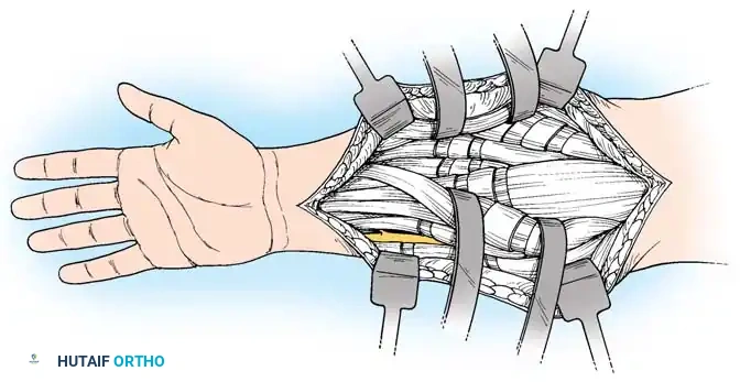 Hutaifortho's Orthopaedic Diagram
