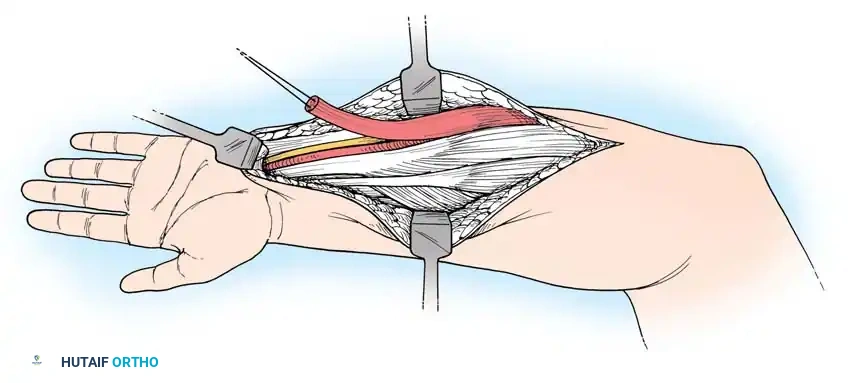 Hutaifortho's Orthopaedic Diagram