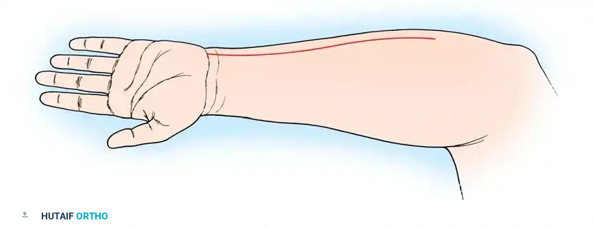 Hutaifortho's Orthopaedic Diagram