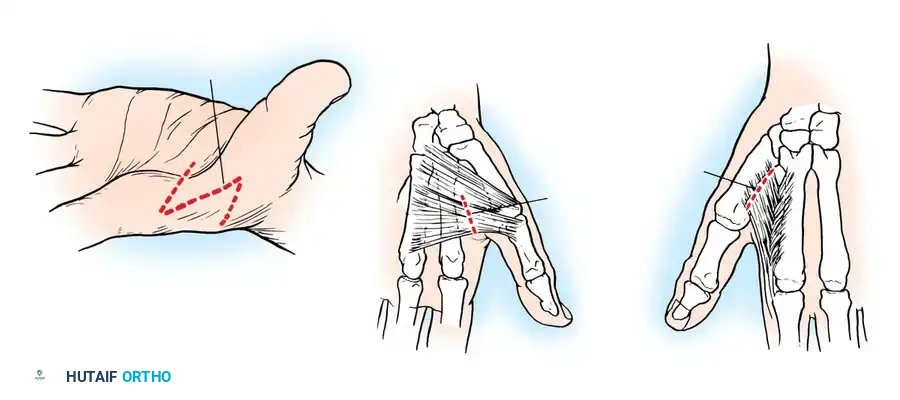 Hutaifortho's Orthopaedic Diagram